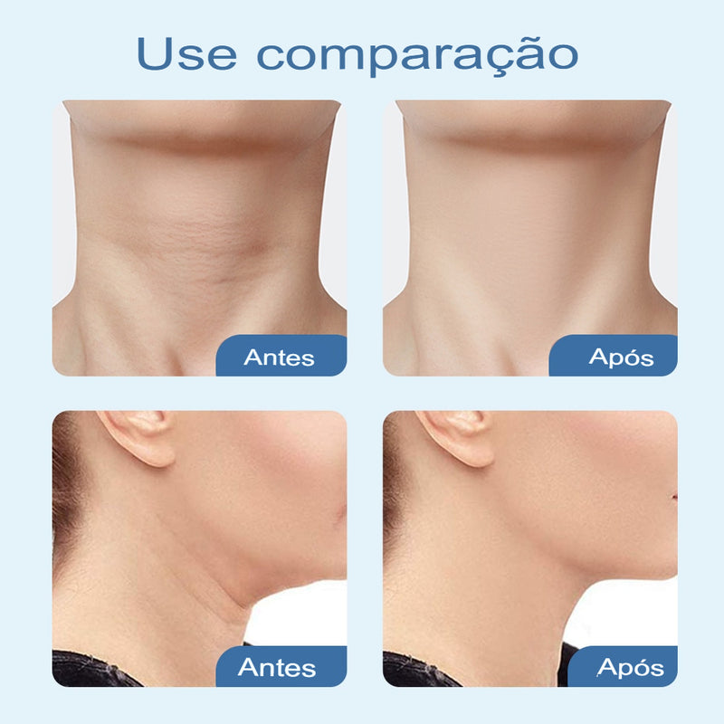 Ultra Rejuvenescedor Facial e Redutor de Papada a Laser - Beauty Skin®️